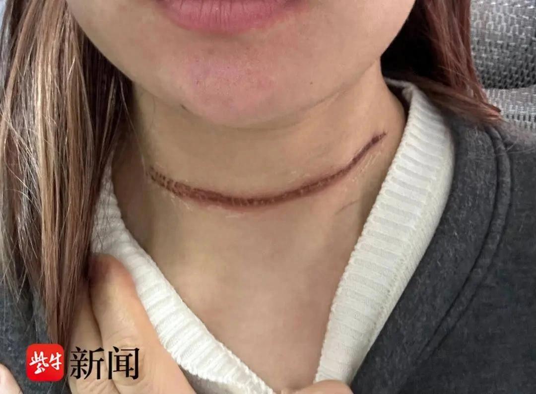 江苏女生参加骑行比赛被风筝线“割喉”！组委会回应  -图1